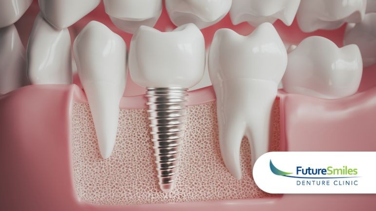 Dental