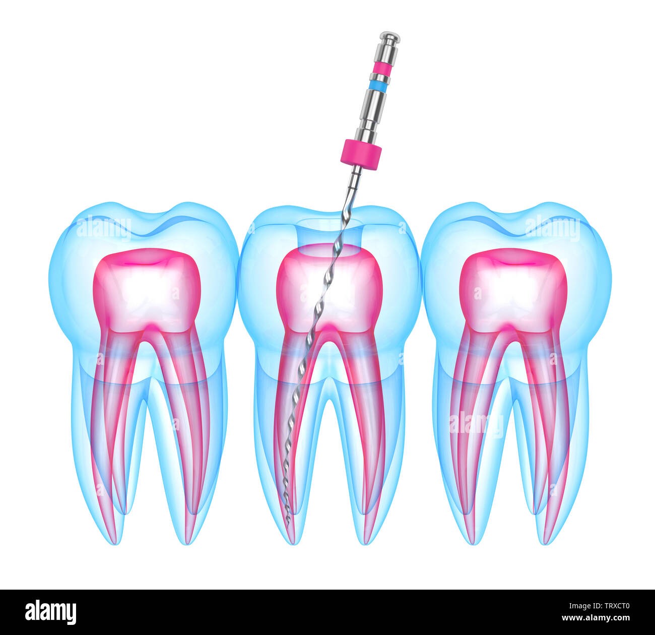 Endodontics