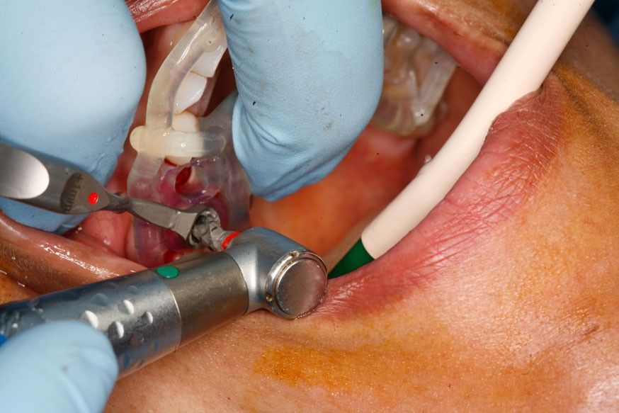 Oral