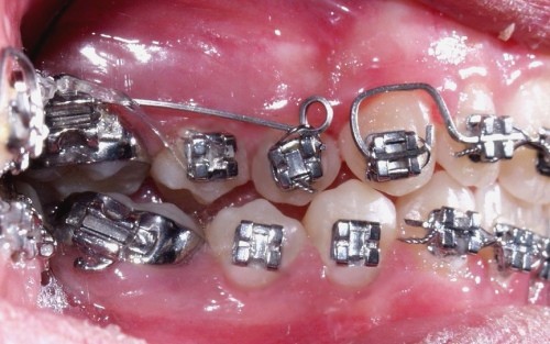 Orthodontics