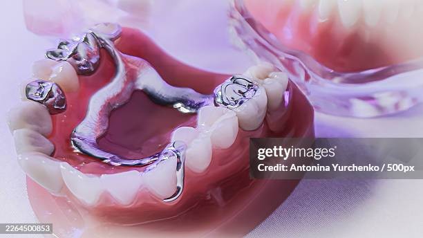 Prosthodontics